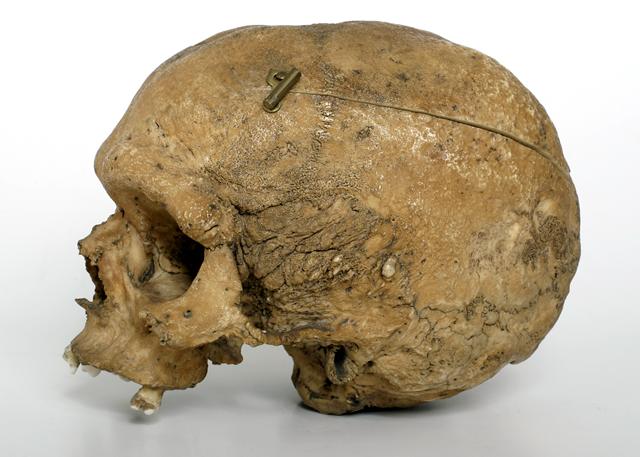 Neanderthaloid Skull 