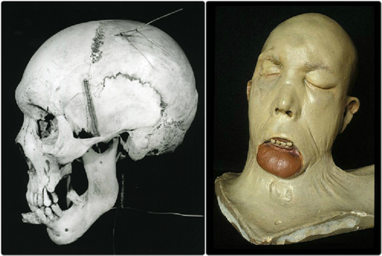 The Skull of John Brogan