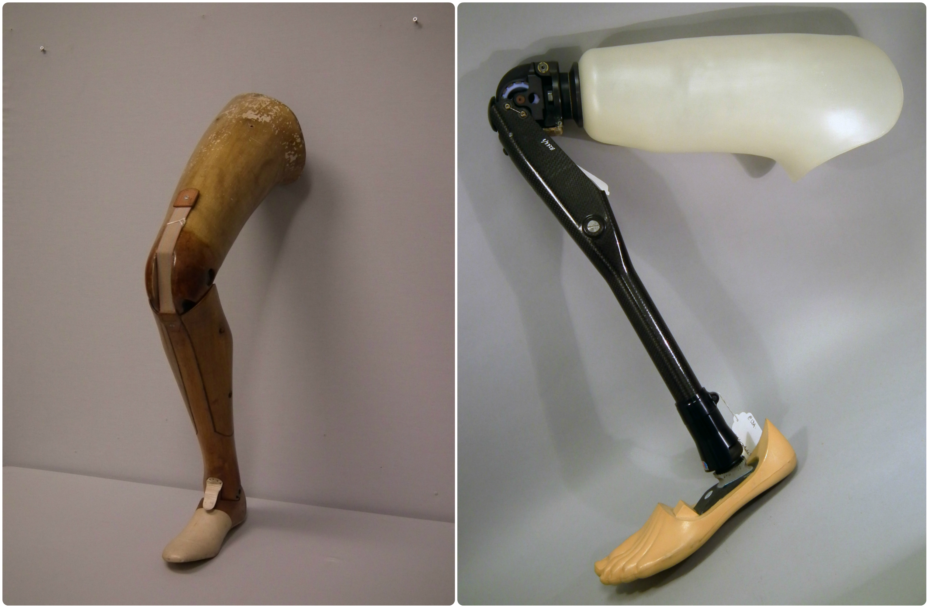 Prosthetic Legs