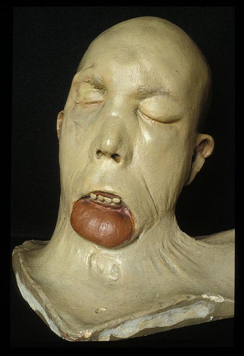 Plaster cast of the head of John Brogan