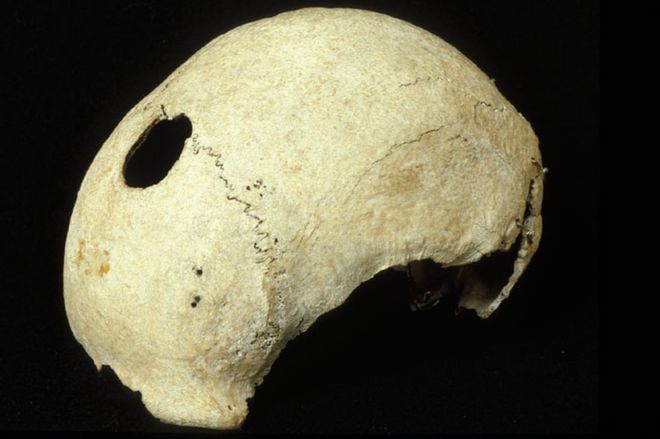 culloden skull.jpg