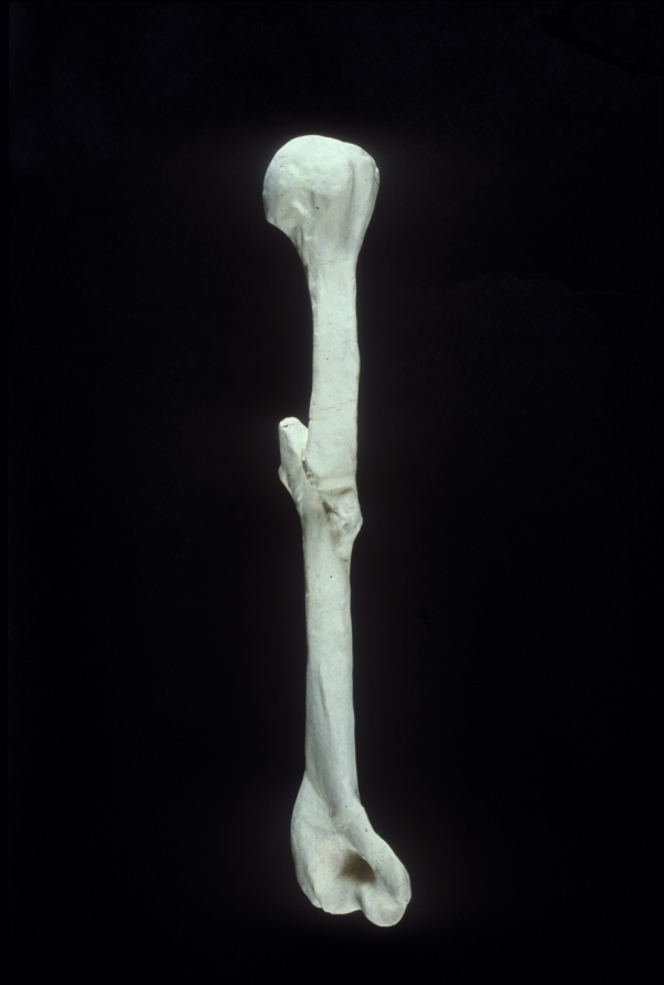 Plaster cast of the Humerus of David Livingstone
