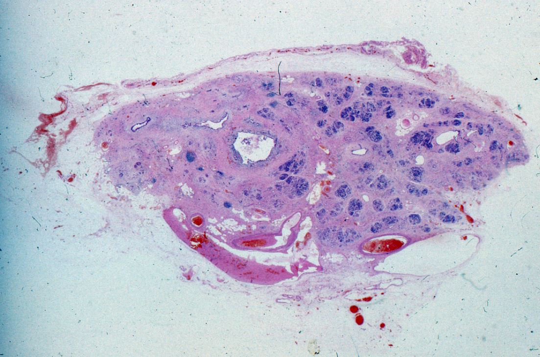 Potted Pathology pt 1