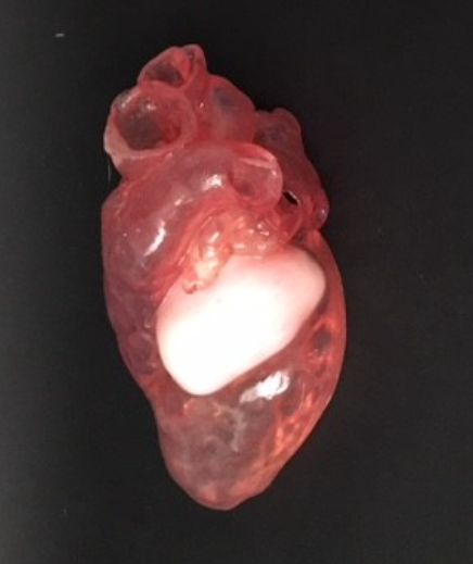 3D printed model of a heart
